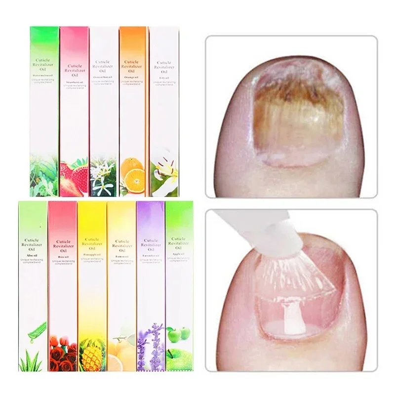 6PCS 큐티클 오일 펜 네일 영양 15 냄새 네일 트 - Cuticle Oil Pen 리뷰 및 가격